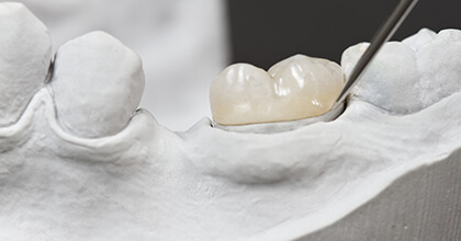 Model of tooth repaired with dental crown