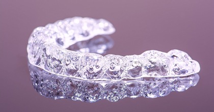 clear aligner