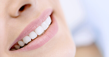 Closeup of smile with flawless porcelain veneers