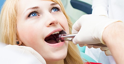 Woman having tooth extracted