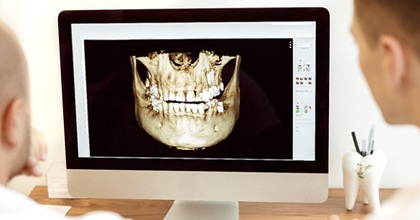 Dentists at computer, planning details of full mouth reconstruction