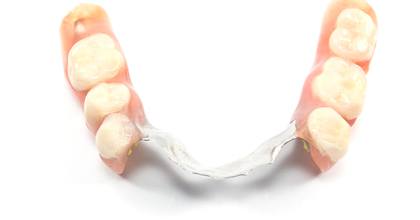 partial denture