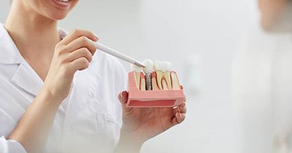 dentist showing a model of a dental implant to a patient 