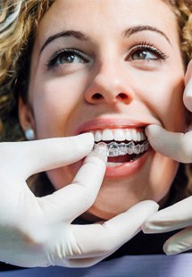 dentist putting Invisalign in patient’s mouth 