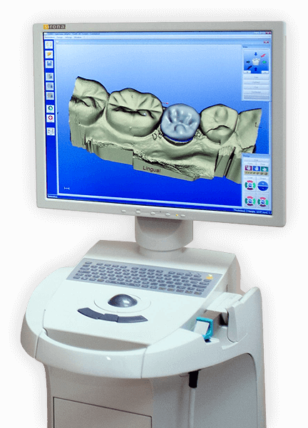 CEREC digital dental crown design on computer monitor