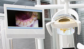Intraoral photo displayed on computer monitor