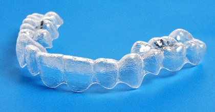 Invisalign aligner