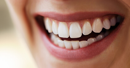Closeup of healthy flawless smile