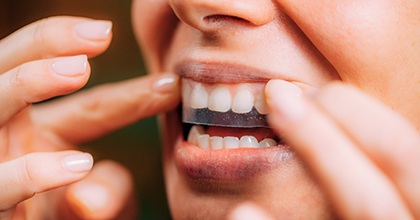 Woman using a teeth whitening strip