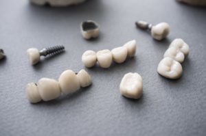 Dental implants and crowns on a desk.