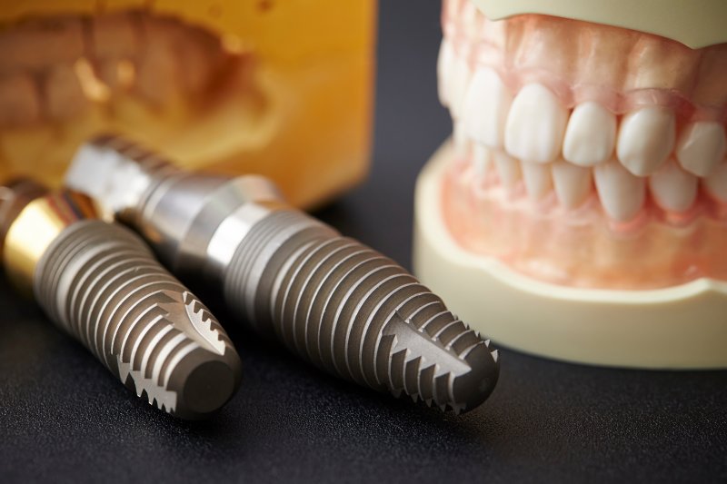 Dentures and dental implants on a desk